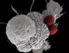 研究阐明了血细胞中的癌前克隆产物