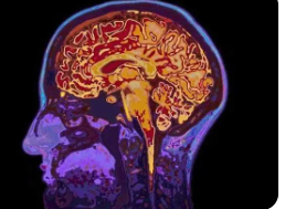 大脑类器官揭示酒精暴露如何损害新脑细胞的发育和功能
