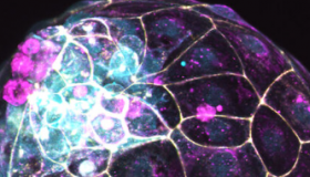 由干细胞制成的Blastoids提供了一种研究生育能力的新方法