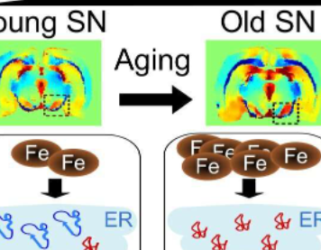 新研究揭示了神经元如何响应与衰老相关的铁积累
