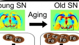 新研究揭示了神经元如何响应与衰老相关的铁积累