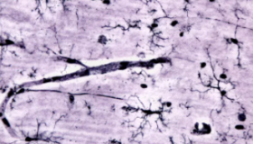 利用小胶质细胞避免神经变性