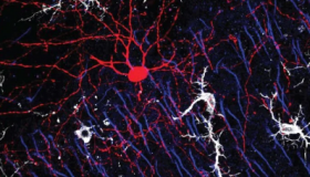 沟通障碍你的大脑如何防止神经元不受控制地放电