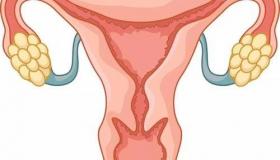 良性卵巢囊肿的最佳治疗方法？ 卵巢囊肿的治疗方法