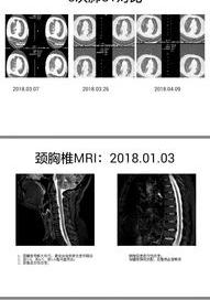 神经内科有哪些疾病？ 神经内科看什么病