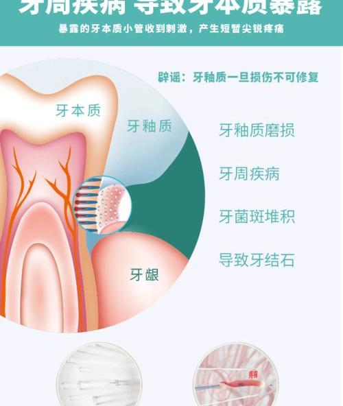 牙齿松动后能固定吗？ 牙齿松动了能恢复吗