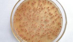 硝化细菌过多有什么影响吗？ 硝化细菌