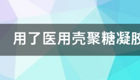 你们清楚萝卜壳聚糖抑菌凝胶多少钱一盒吗？ 医用壳聚糖凝胶价格