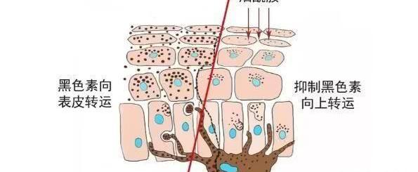 皮肤被晒黑了怎么快速变白？ 晒黑了怎么快速修复变白