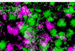 科学家发现调节细菌感染的小RNA