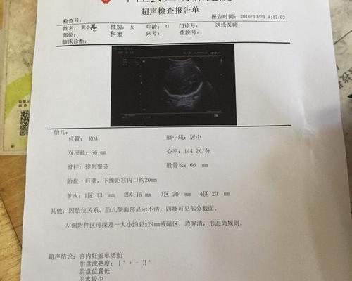 羊水正常值是多少mm？ 羊水指数