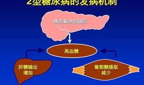 二型糖尿病是什么？ 2型糖尿病