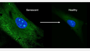新的药物输送方法可以逆转干细胞的衰老
