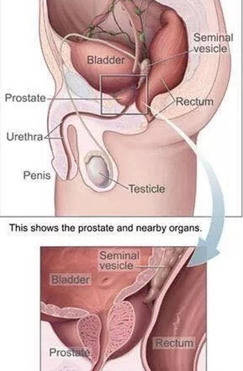 慢性前列腺炎有什么症状？ 慢性前列腺炎症状