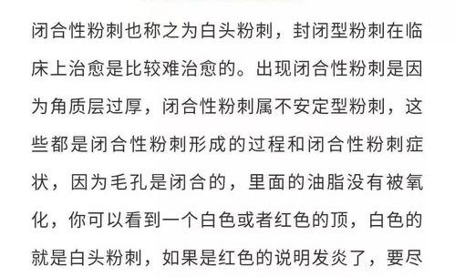 怎么消除闭合性粉刺的呢？ 闭合性粉刺怎么才能根除