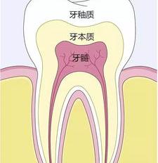 如何修复牙釉质 牙釉质其实可以慢慢修复