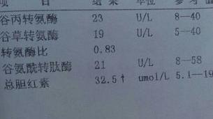 长期三种胆红素偏高是何原因？ 三个胆红素都偏高原因