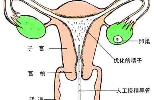 做了四次人工授精都没成功，该怎么办？ 人工授精十个有九个不成功吗