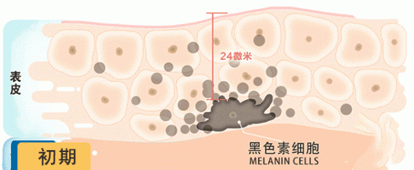 怎么内调祛斑最好的方法 黄褐斑怎样内调效果好