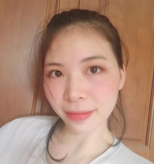 宝宝长了湿疹怎么办？ 婴儿湿疹怎么办好得快