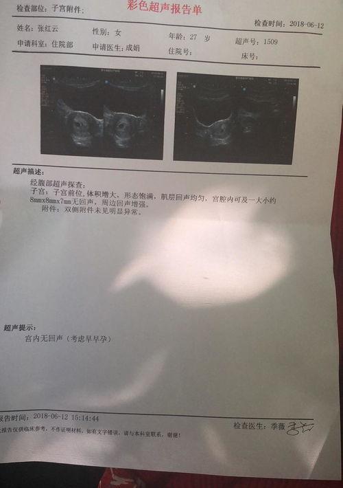 宫外孕后还能怀孕吗？ 宫外孕后还能正常怀孕吗